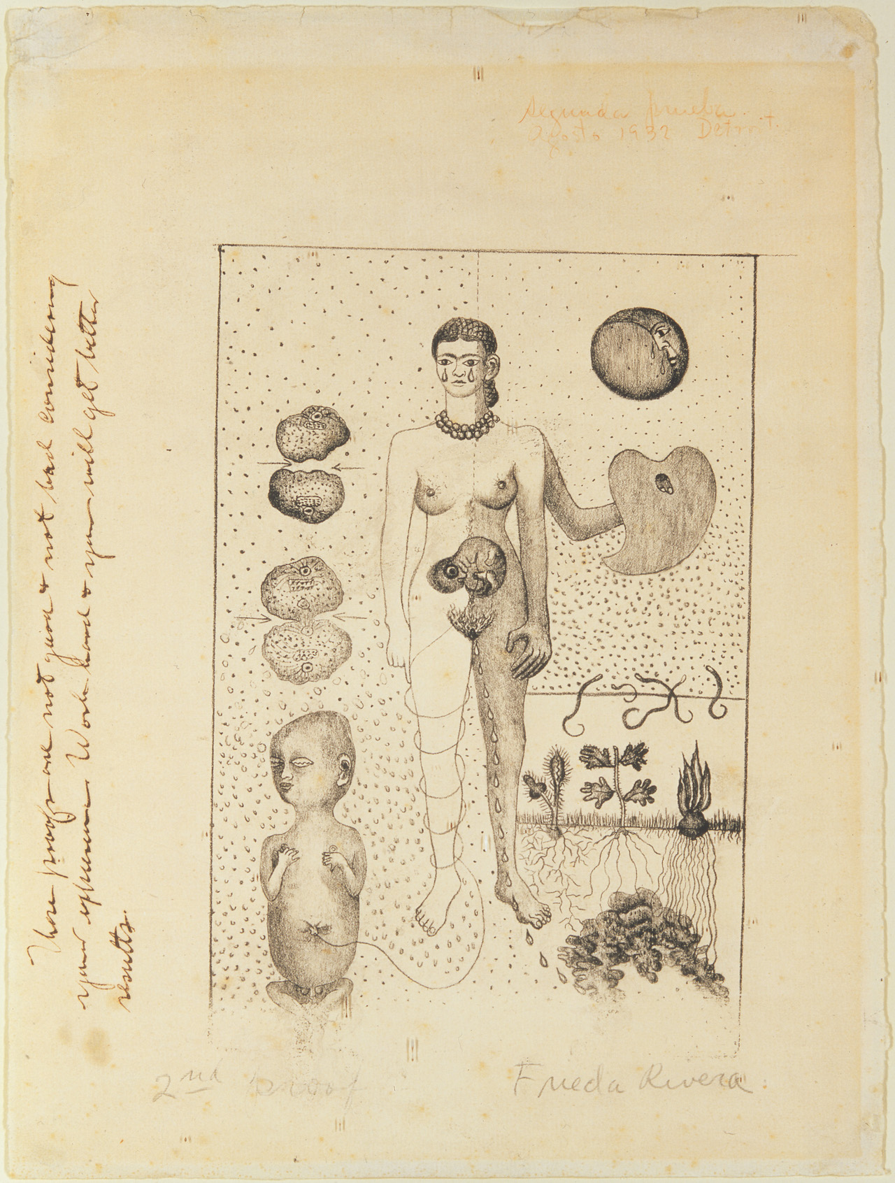 Frida et la fausse couche, œuvre de Frida Kahlo — Collection privée ou localisation à vérifier — ressource institutionnelle